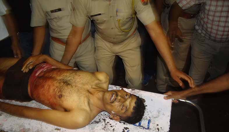 injured in police firing anandpal