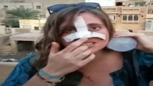 british woman injured bull attack jaisalmer