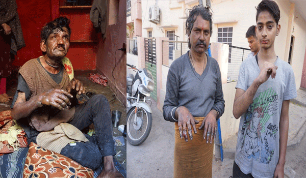 three-people-injured-in-fire-at-mansarovar-jaipur